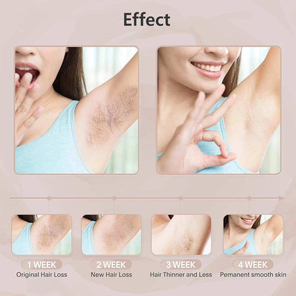 Laser Epilator IPL Hair Removal For Women Body Bikini Facial 990000 Flashes Permanant Painless IPL Hair Remover Laser Epilator