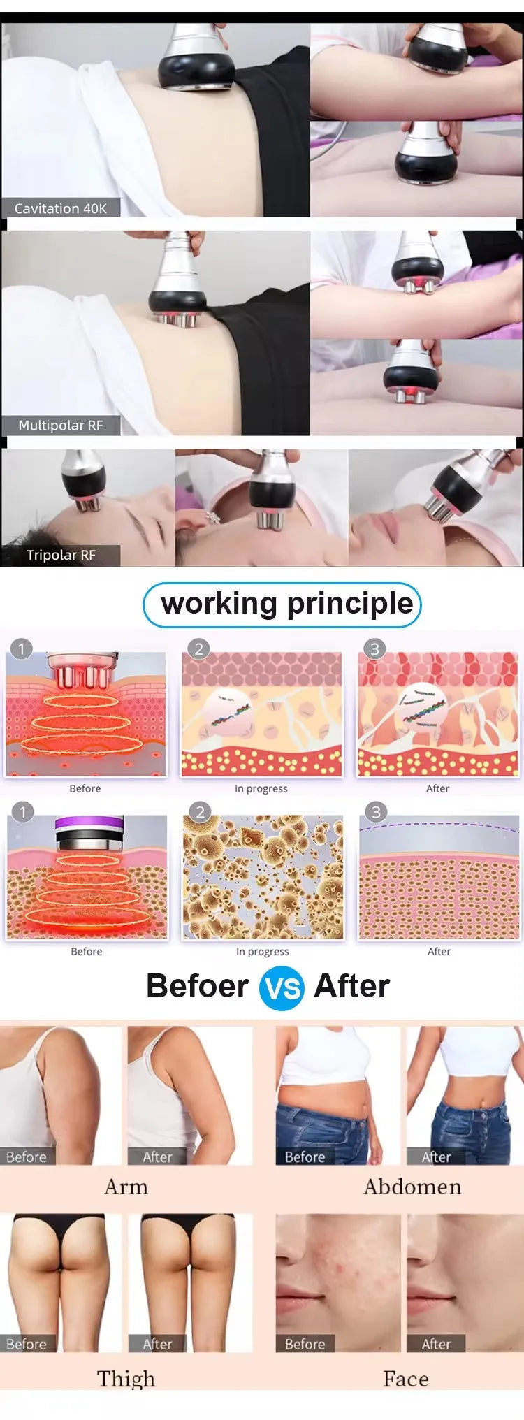 3 in1 40K Ultrasonic Cavitation Machine Body Slimming Massager RF Weight Loss Beauty Skin Tighten Lift Skin Rejuvenation